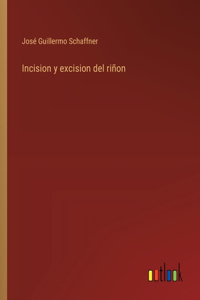 Incision y excision del riñon