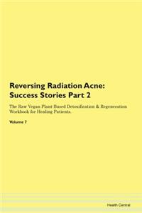 Reversing Radiation Acne: Success Storie