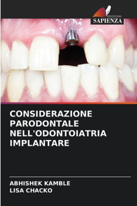 Considerazione Parodontale Nell'odontoiatria Implantare