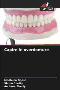 Capire le overdenture