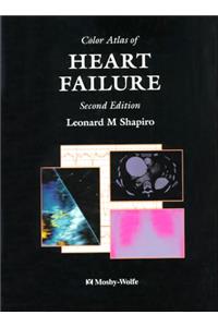 Color Atlas of Heart Failure