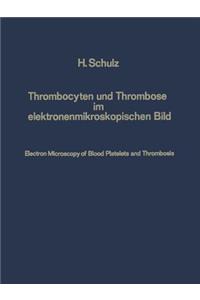 Thrombocyten Und Thrombose Im Elektronenmikroskopischen Bild / Electron Microscopy of Blood Platelets and Thrombosis