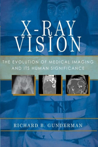 X-Ray Vision