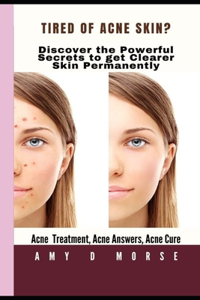 TIRED OF ACNE SKIN? Discover the Powerful Secrets to get clearer skin Permanently