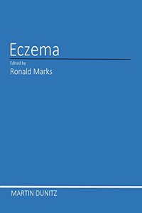 Eczema