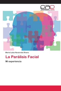 Parálisis Facial