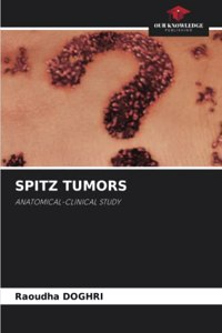 Spitz Tumors