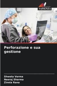 Perforazione e sua gestione