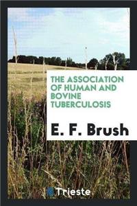 Association of Human and Bovine Tuberculosis