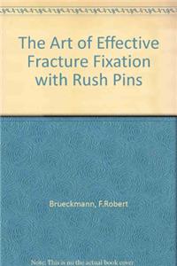 The Art of Effective Fracture Fixation with Rush Pins