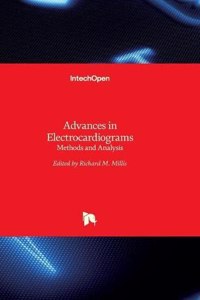 Advances in Electrocardiograms