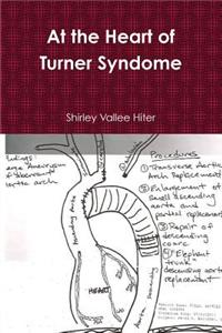 At The Heart of Turner Syndrome