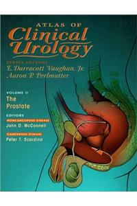 The Prostate (Atlas of Clinical Urology)