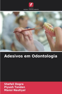 Adesivos em Odontologia