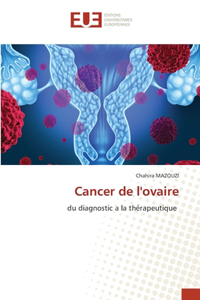 Cancer de l'ovaire