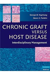 Chronic Graft Versus Host Disease