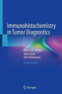 Immunohistochemistry in Tumor Diagnostics