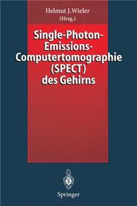 Single-Photon-Emissions-Computertomographie (Spect) Des Gehirns