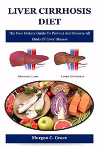 Liver Cirrhosis Diet