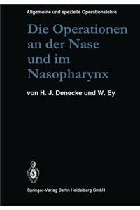 Operationen an Der Nase Und Im Nasopharynx