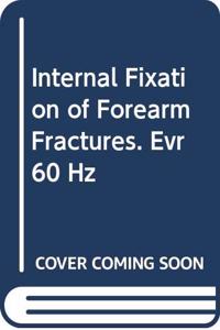 Internal Fixation of Forearm Fractures. Evr 60 Hz