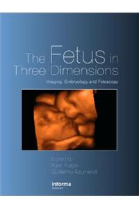 Fetus in Three Dimensions