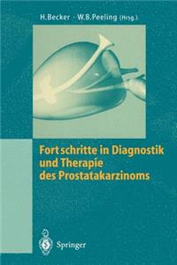 Fortschritte in Diagnostik Und Therapie Des Prostatakarzinoms