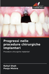 Progressi nelle procedure chirurgiche implantari