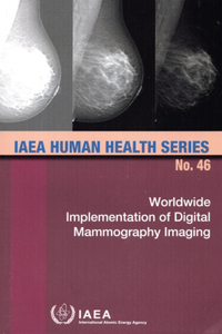 Worldwide Implementation of Digital Mammography Imaging