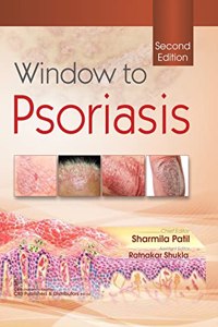 Window to Psoriasis, 2/e Hardcover - 1 January 2021