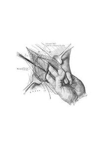 Muscle-Splitting Incision Notebook