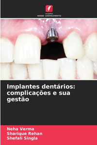 Implantes dentários