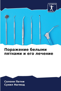 Поражение белыми пятнами и его лечение