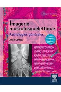 Imagerie Musculosquelettique: Pathologies Générales