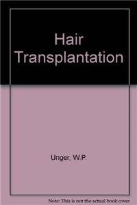 Hair Transplantation