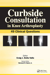 Curbside Consultation in Knee Arthroplasty