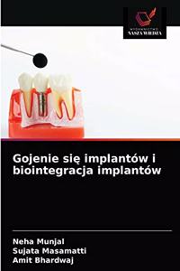 Gojenie si&#281; implantów i biointegracja implantów