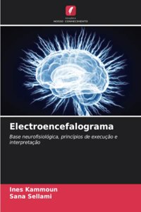 Electroencefalograma
