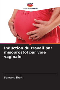 Induction du travail par misoprostol par voie vaginale