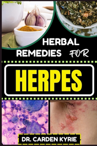 Herbal Remedies for Herpes