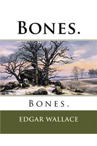 Bones.