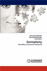 Genioplasty