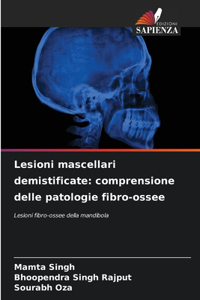 Lesioni mascellari demistificate