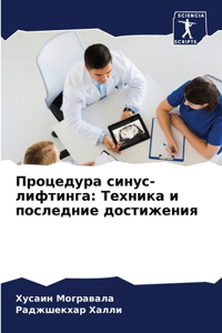 Процедура синус-лифтинга