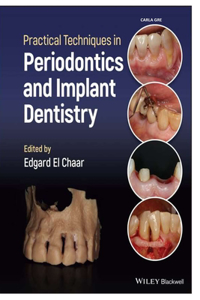 Practical Techniques in Periodontics and Implant Dentistry