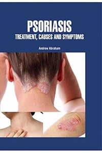 PSORIASIS: TREATMENT, CAUSES AND SYMPTOMS