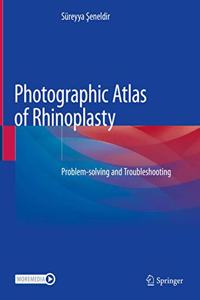 Photographic Atlas of Rhinoplasty