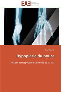 Hypoplasie du pouce