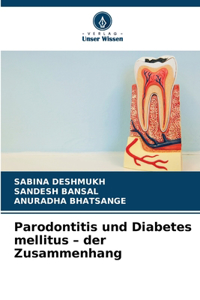 Parodontitis und Diabetes mellitus - der Zusammenhang