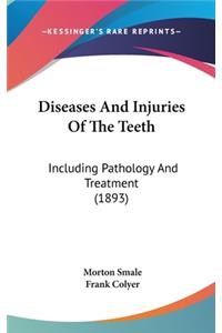 Diseases and Injuries of the Teeth